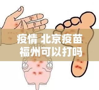 疫情 北京疫苗 福州可以打吗（疫情 北京疫苗 福州可以打吗现在）
