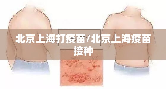 北京上海打疫苗/北京上海疫苗接种