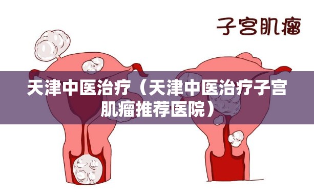 天津中医治疗（天津中医治疗子宫肌瘤推荐医院）