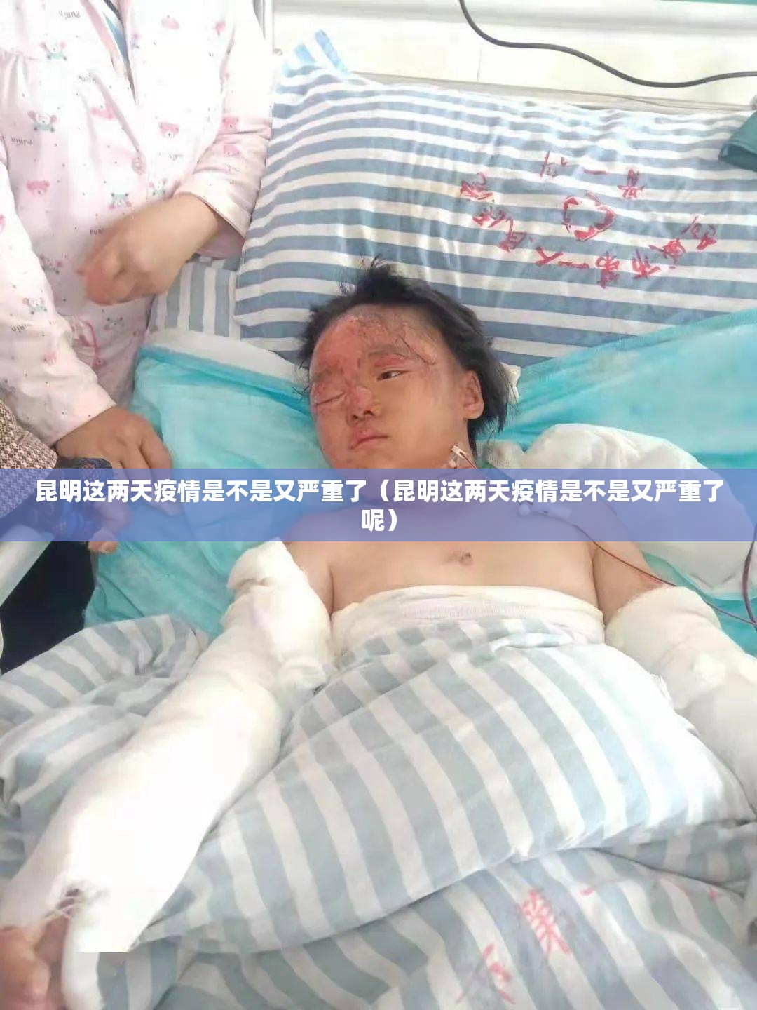 昆明这两天疫情是不是又严重了（昆明这两天疫情是不是又严重了呢）