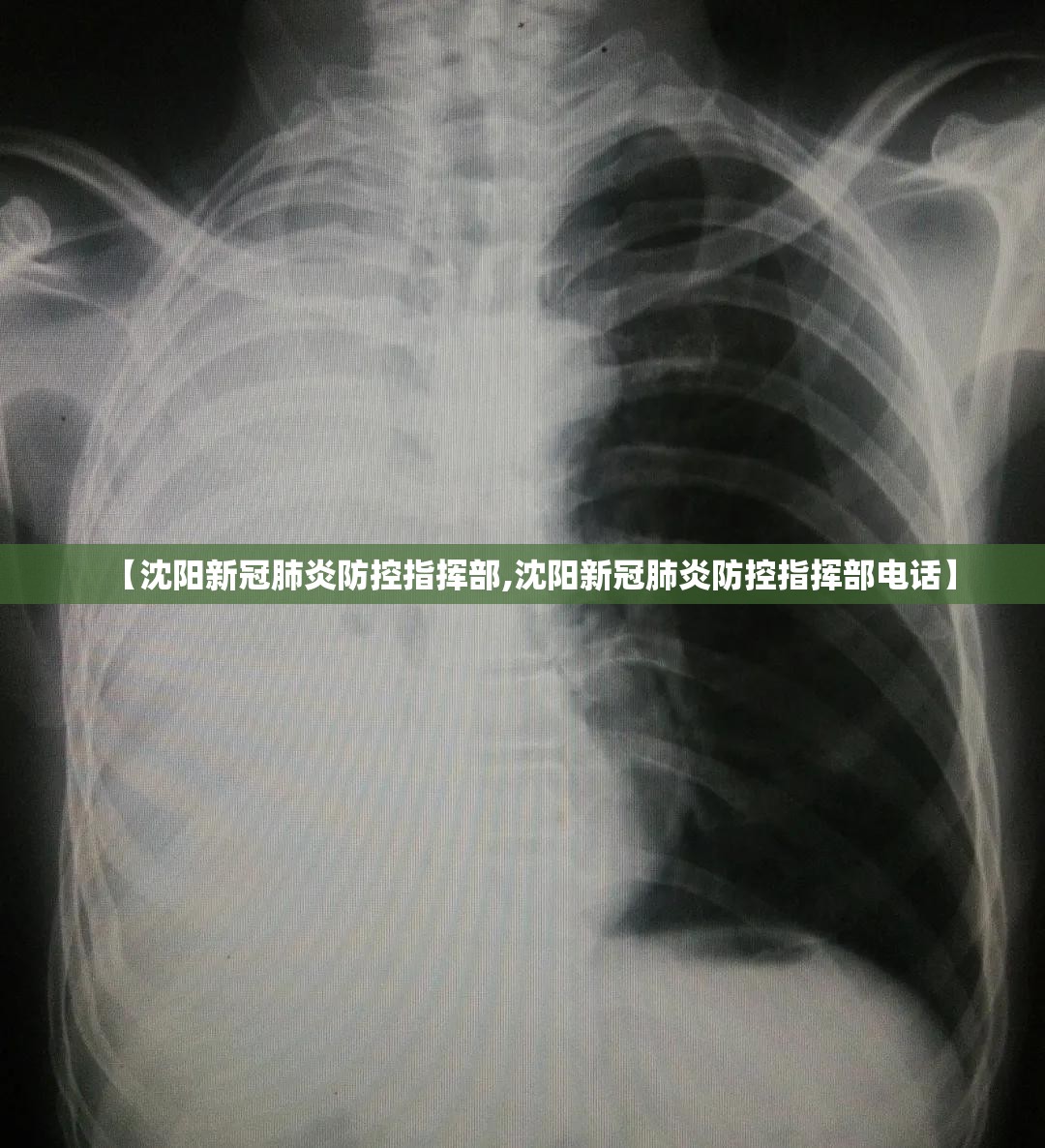 【沈阳新冠肺炎防控指挥部,沈阳新冠肺炎防控指挥部电话】