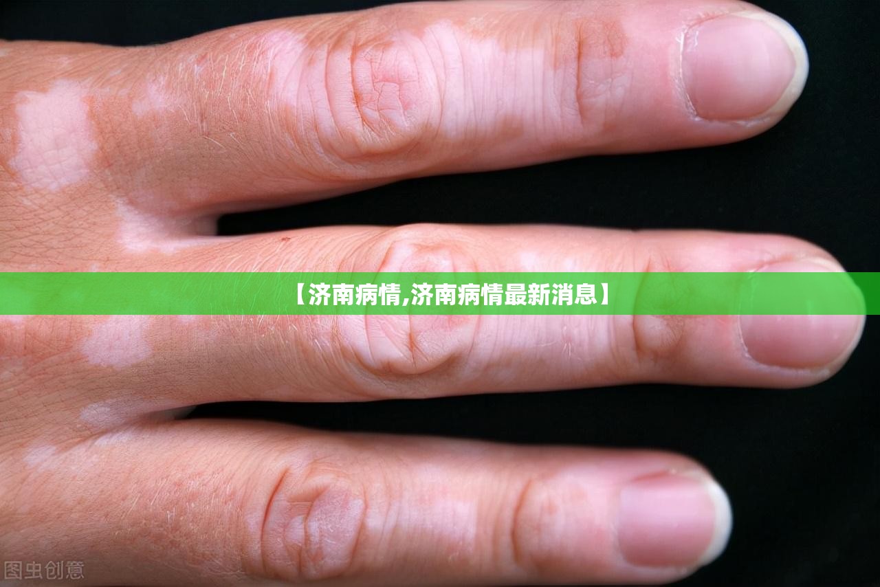 【济南病情,济南病情最新消息】