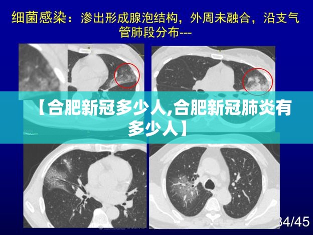 【合肥新冠多少人,合肥新冠肺炎有多少人】